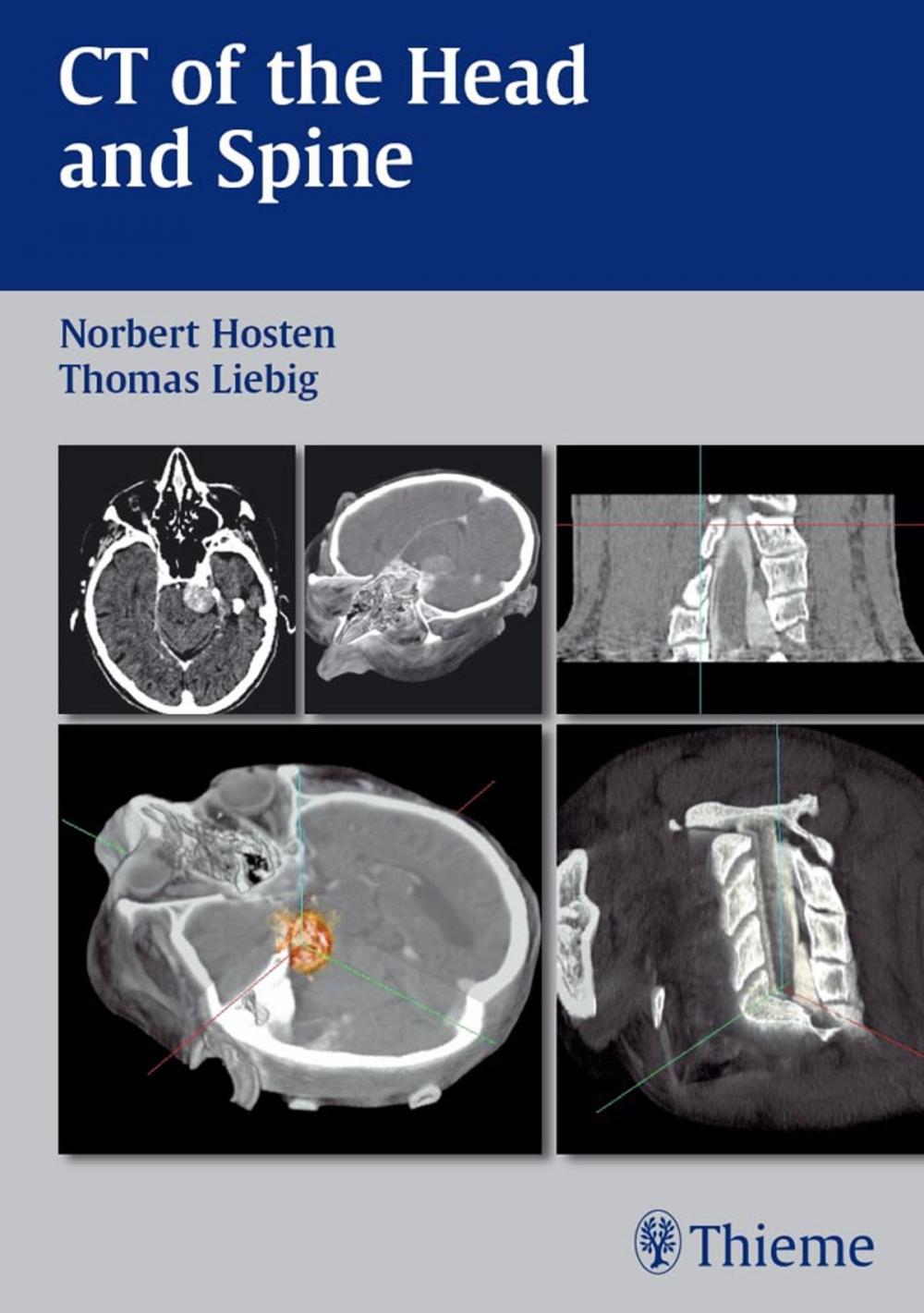 Big bigCover of CT of the Head and Spine