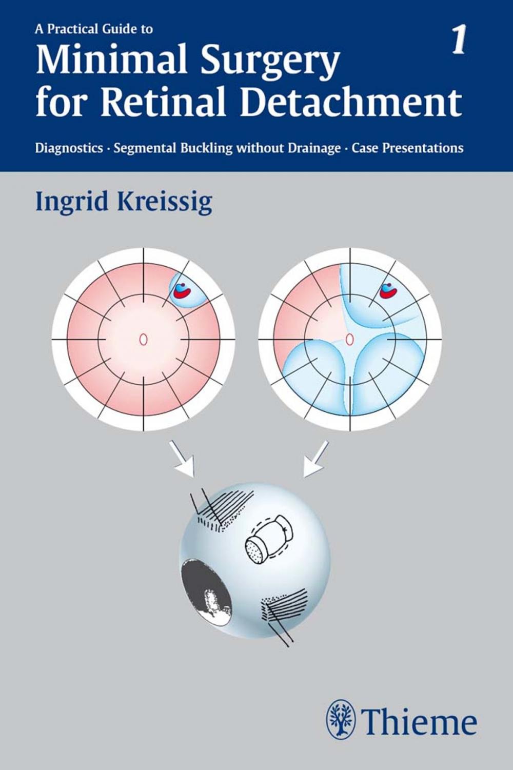 Big bigCover of Practical Guide to Minimal Surgery for Retinal Detachment