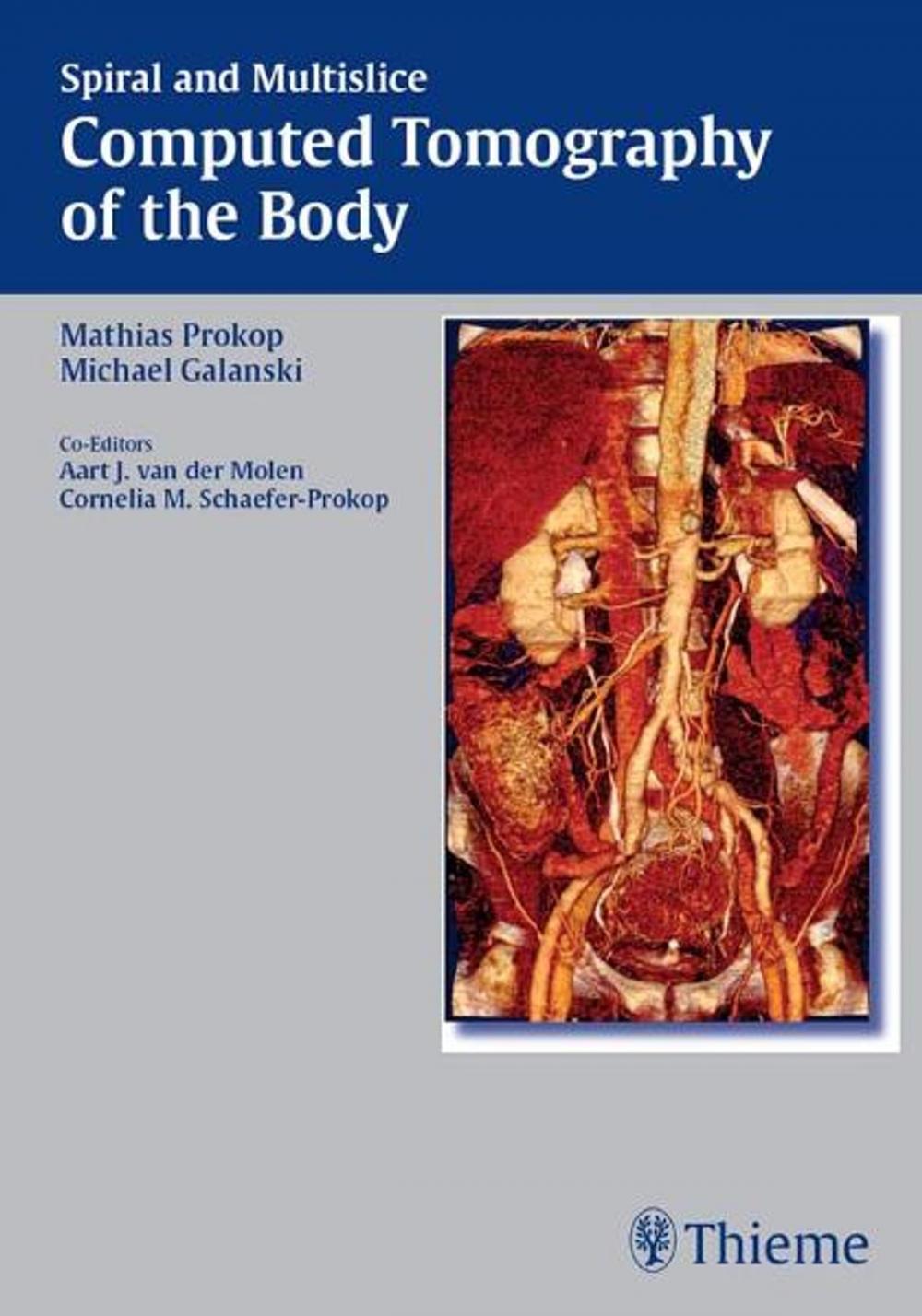 Big bigCover of Spiral and Multislice Computed Tomography of the Body