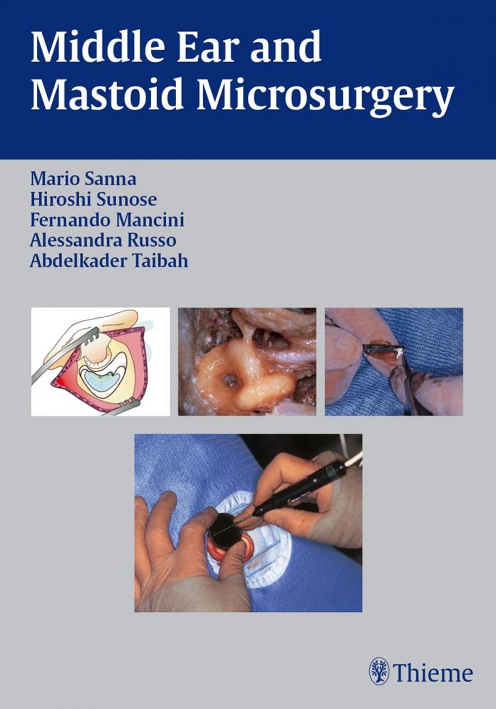 Big bigCover of Middle Ear and Mastoid Microsurgery