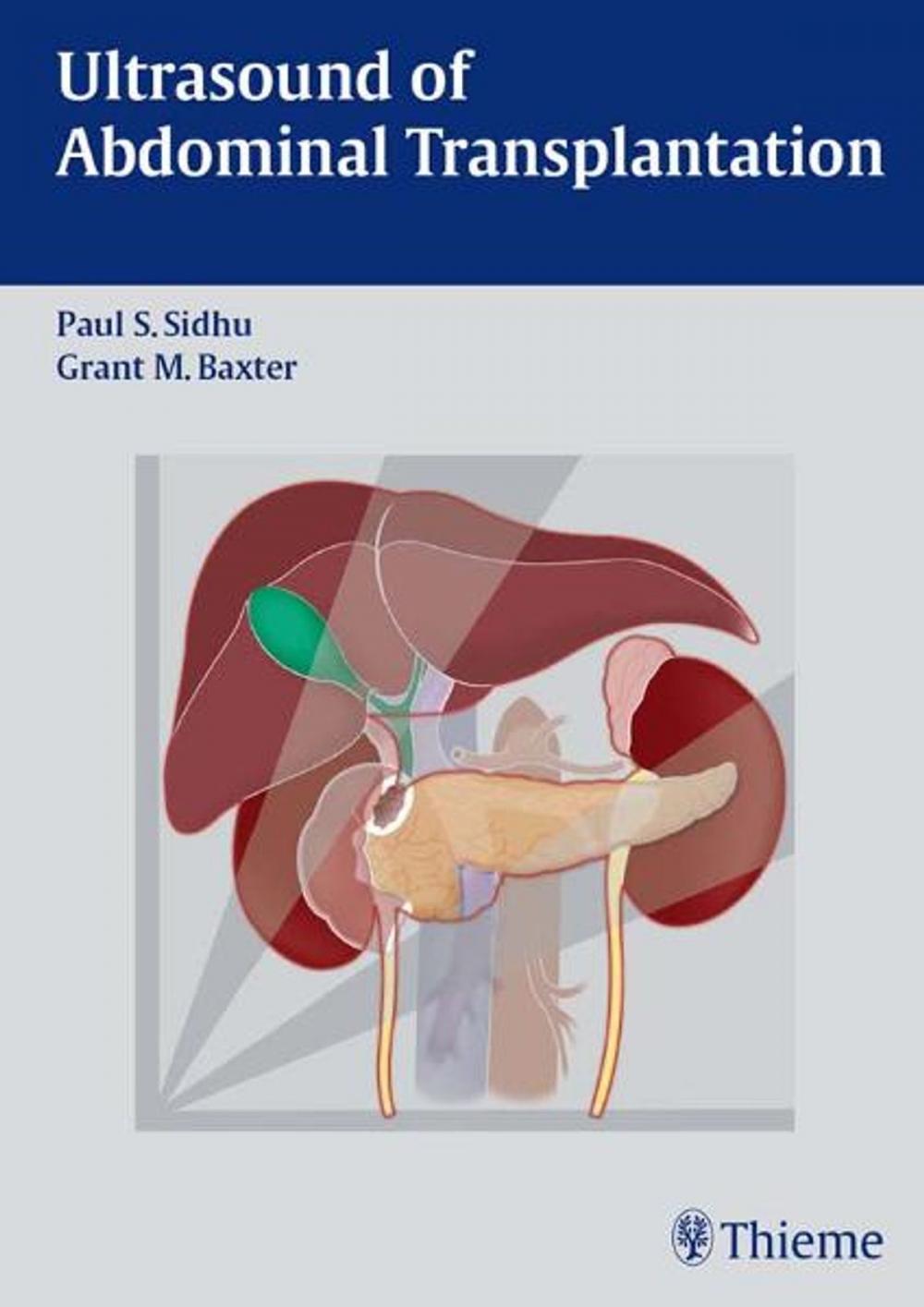 Big bigCover of Ultrasound of Abdominal Transplantation