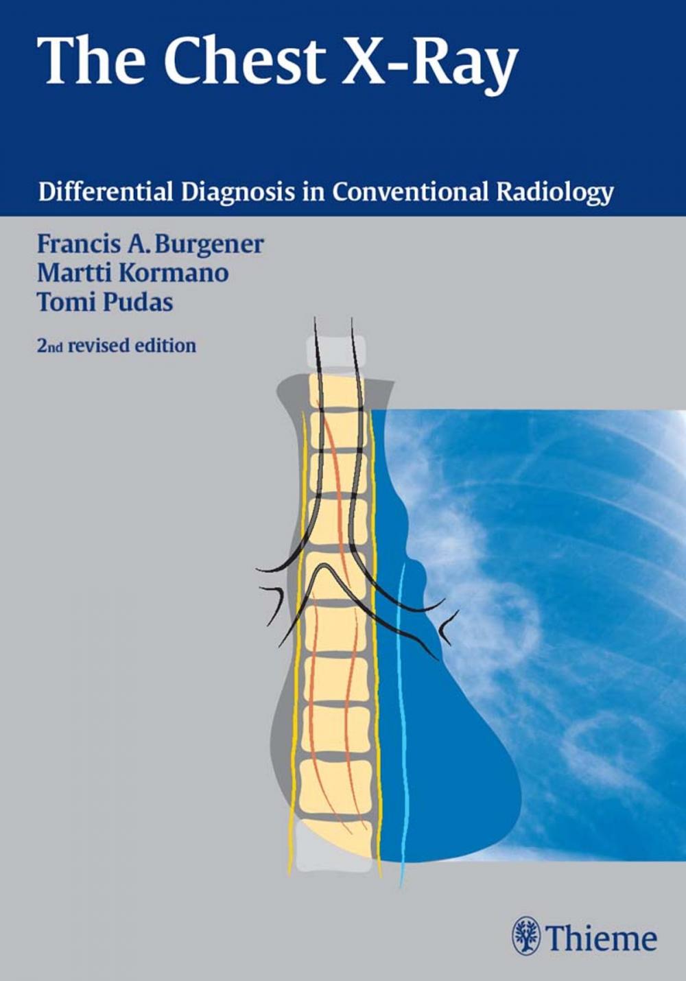 Big bigCover of Chest X-Ray