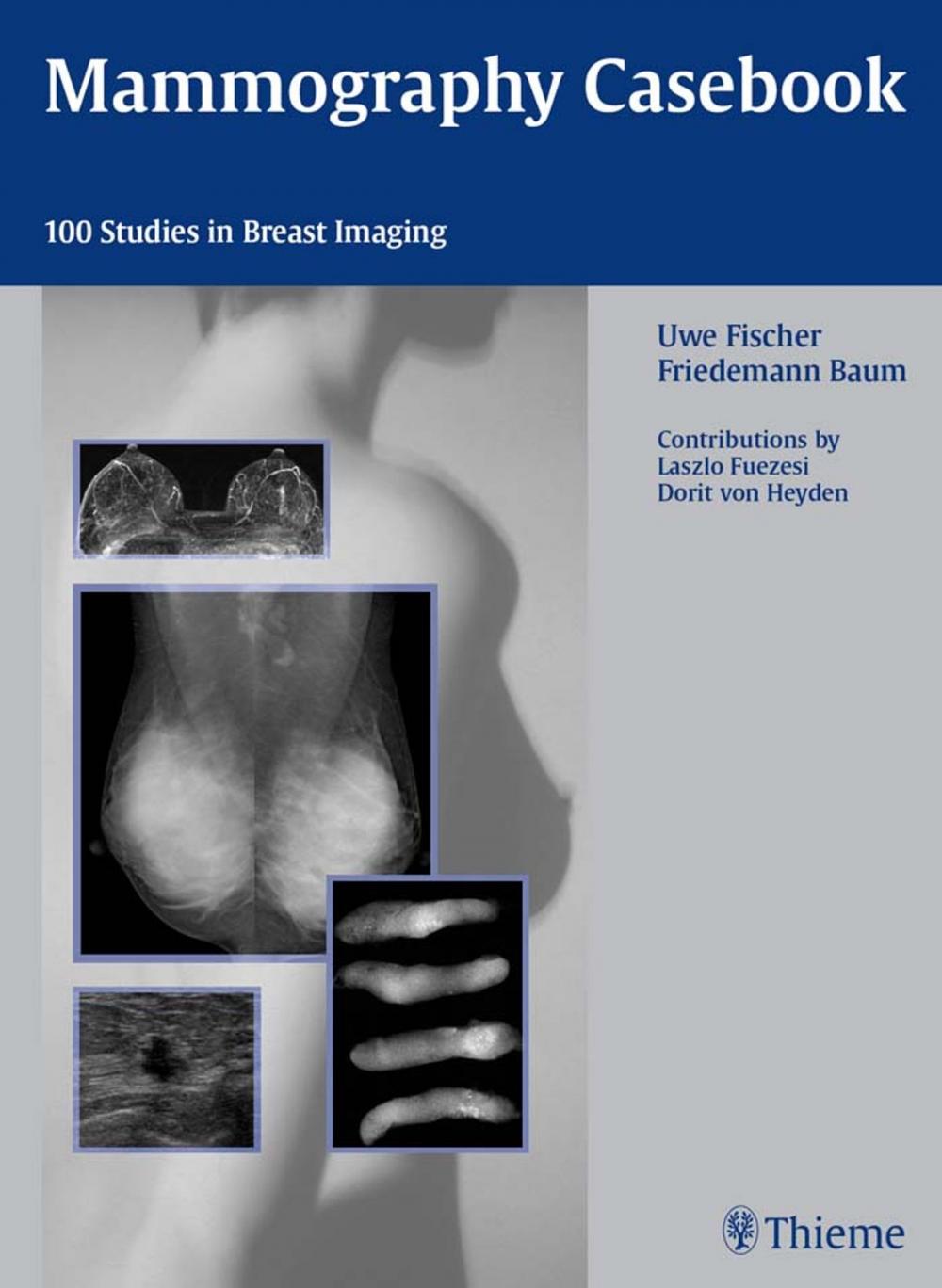Big bigCover of Mammography Casebook