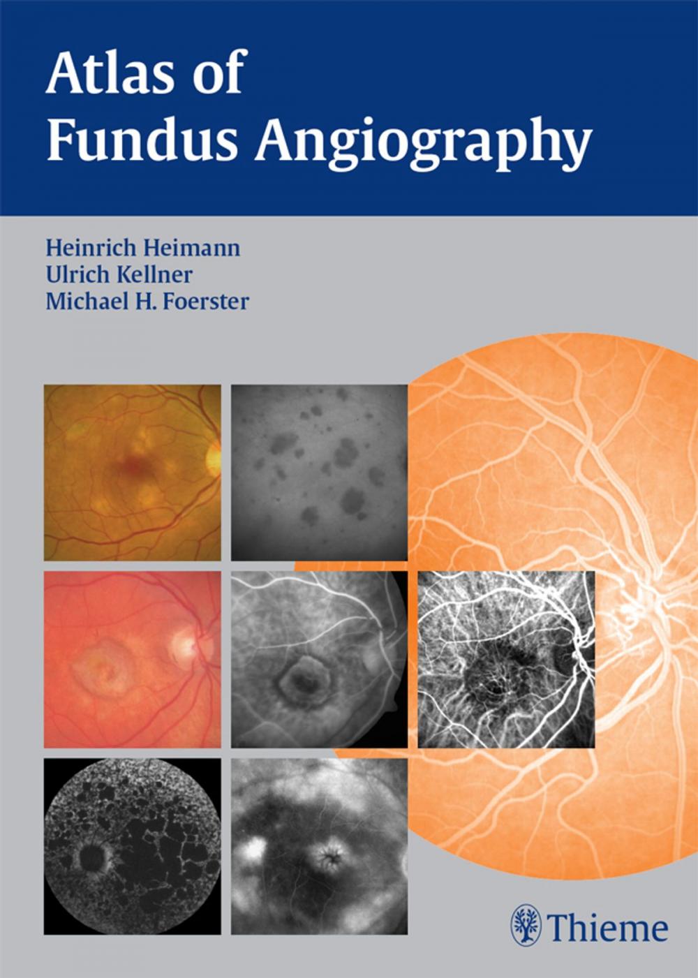 Big bigCover of Atlas of Fundus Angiography