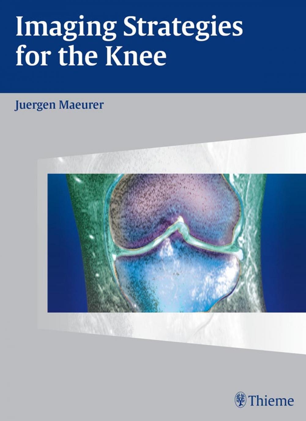 Big bigCover of Imaging Strategies for the Knee