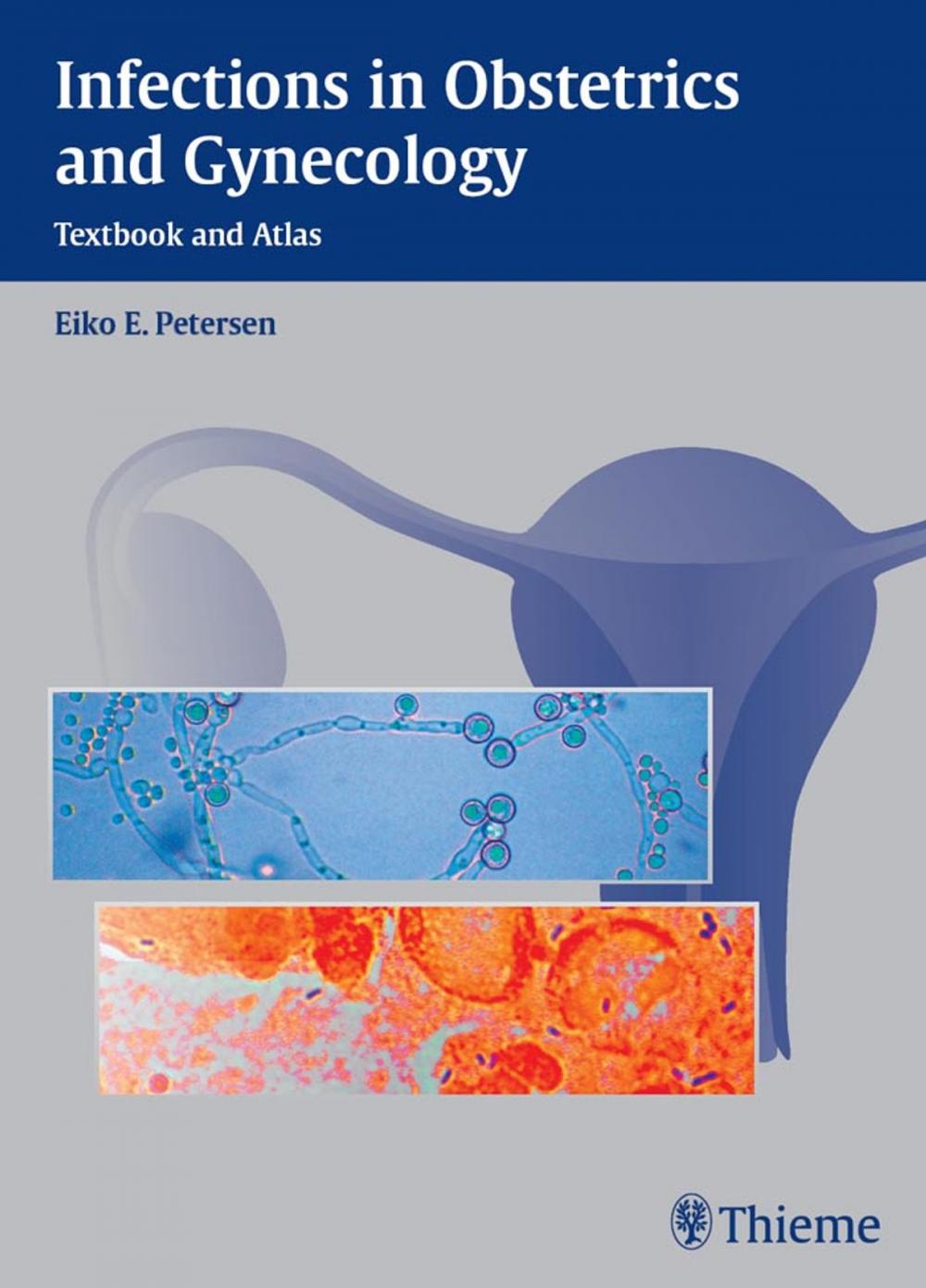 Big bigCover of Infections in Obstetrics and Gynecology