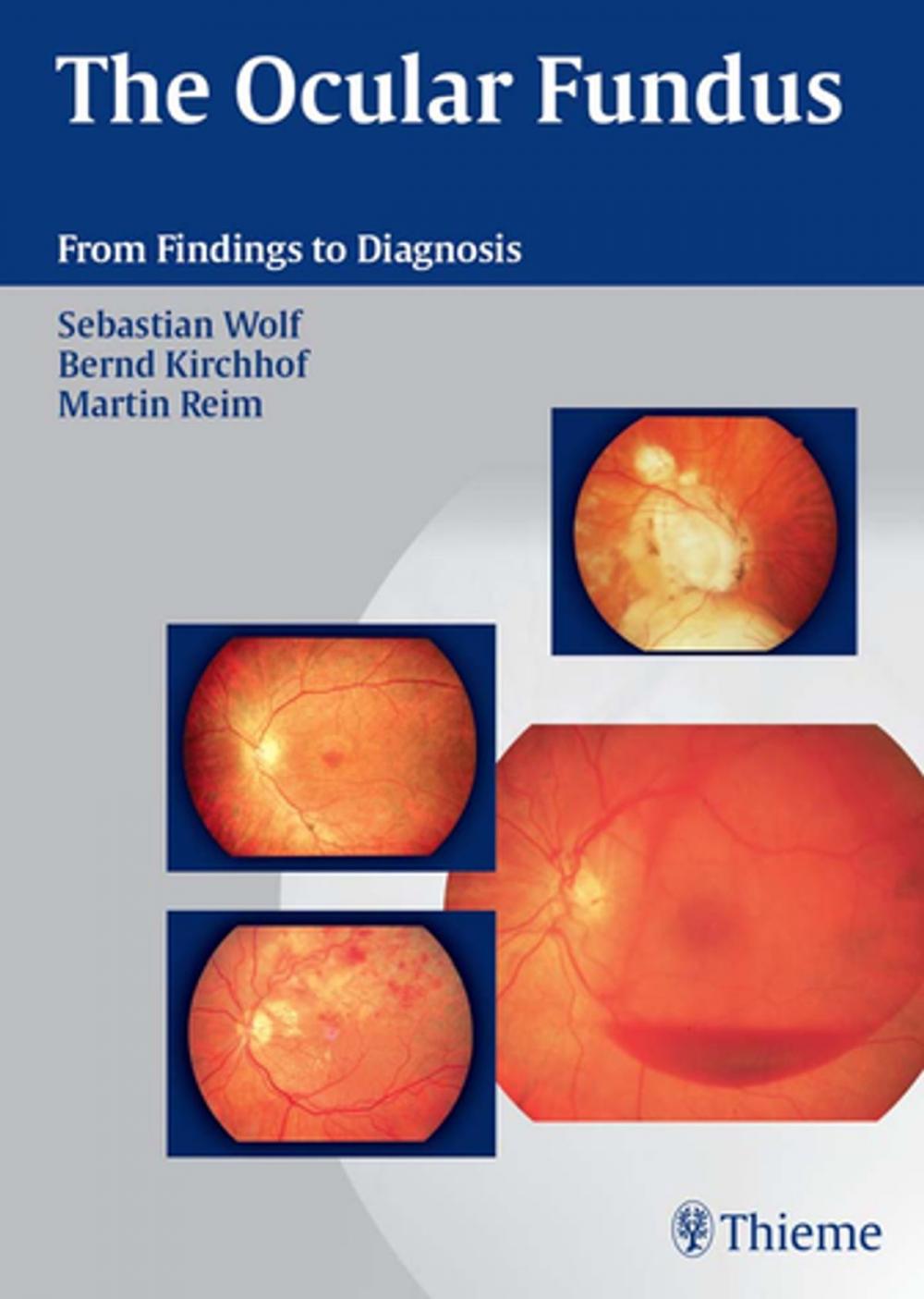 Big bigCover of Ocular Fundus