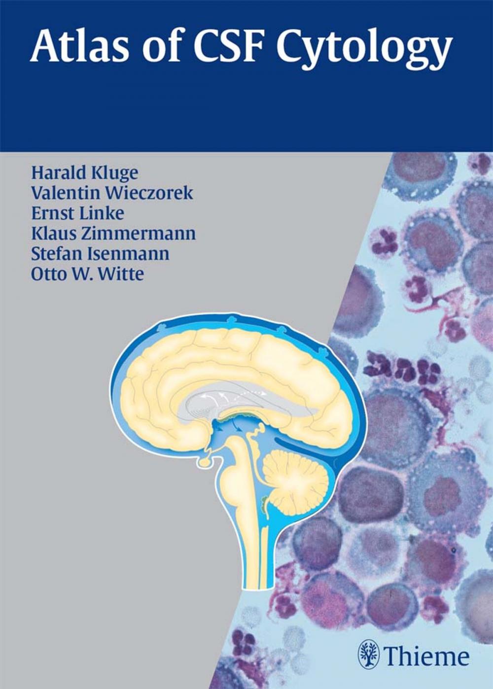 Big bigCover of Atlas of CSF Cytology