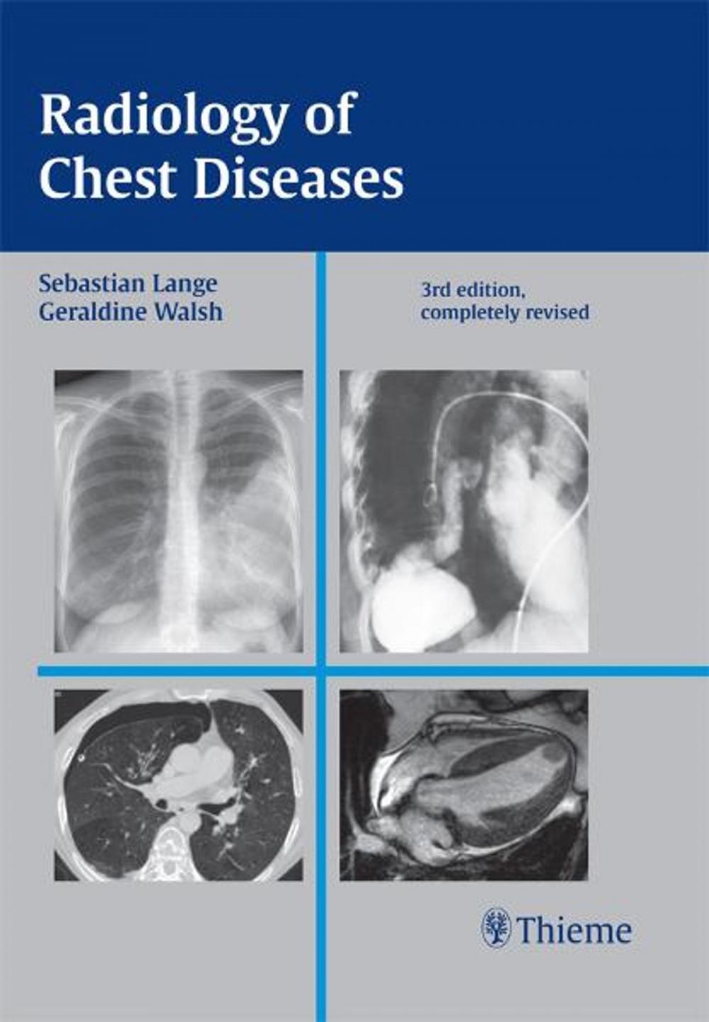 Big bigCover of Radiology of Chest Diseases