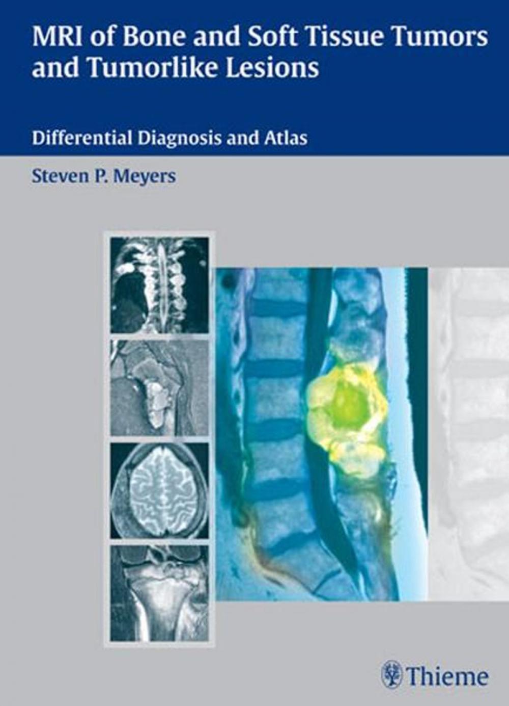 Big bigCover of MRI of Bone and Soft Tissue Tumors and Tumorlike Lesions