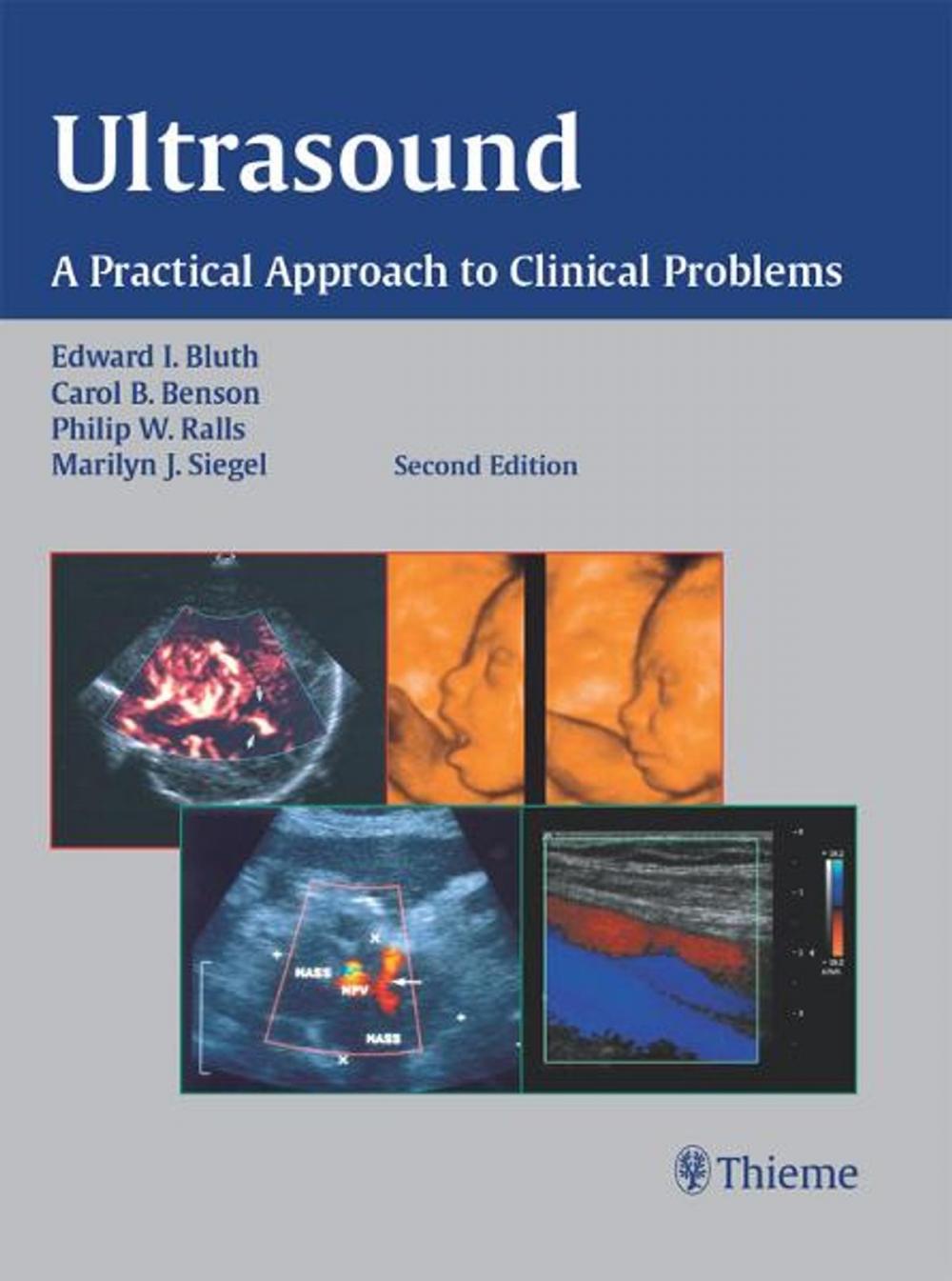 Big bigCover of Ultrasound