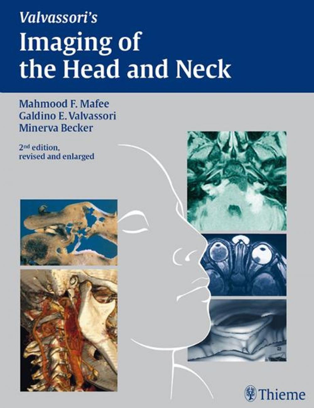 Big bigCover of Imaging of the Head and Neck