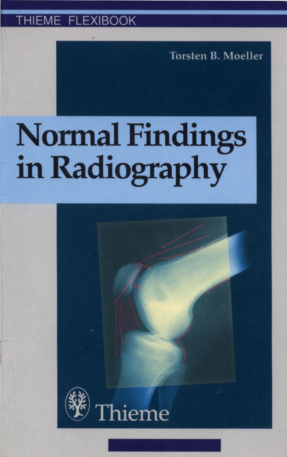 Big bigCover of Normal Findings in Radiography