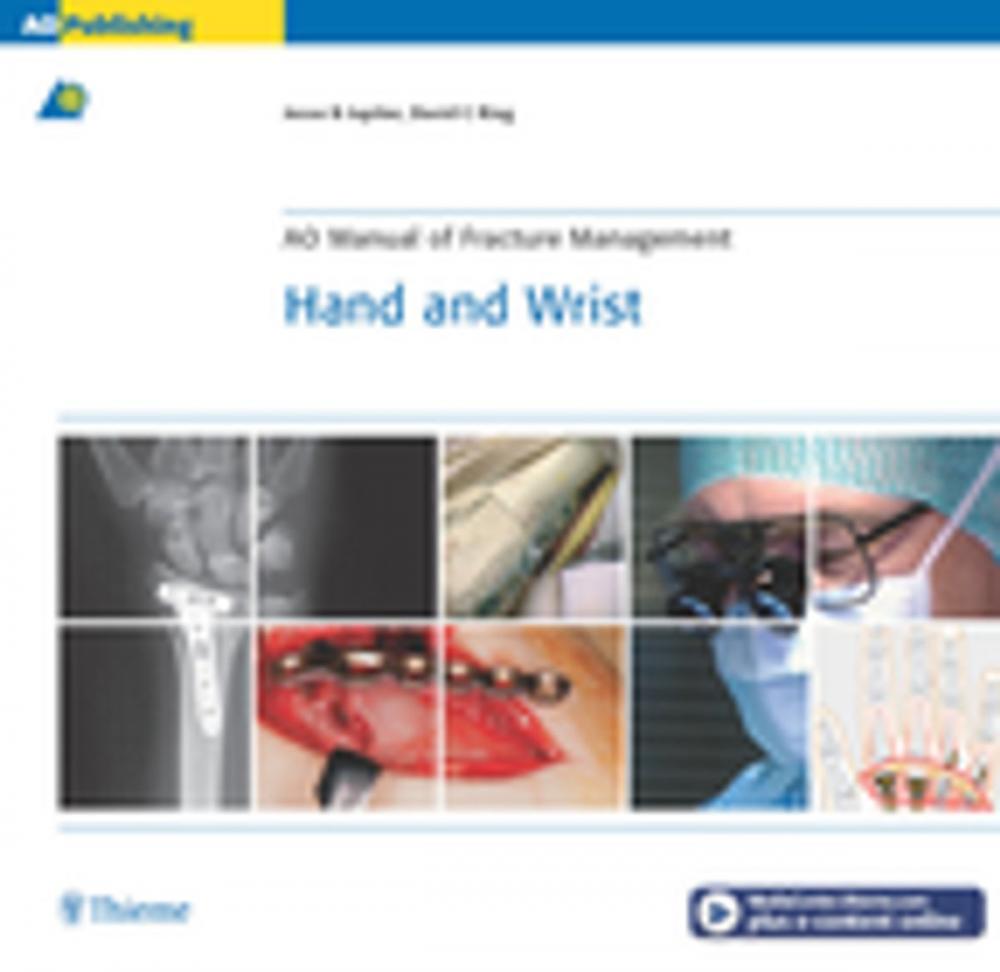 Big bigCover of AO Manual of Fracture Management: Hand & Wrist