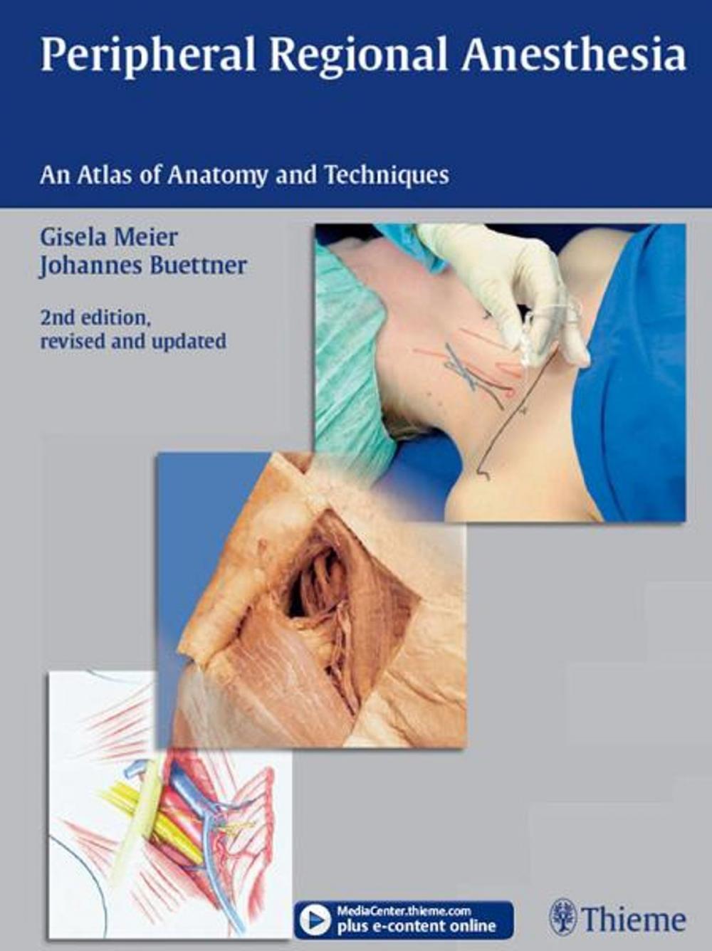 Big bigCover of Peripheral Regional Anesthesia