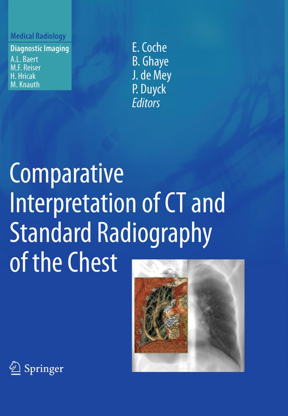 Big bigCover of Comparative Interpretation of CT and Standard Radiography of the Chest