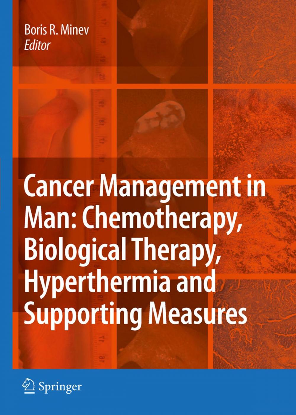 Big bigCover of Cancer Management in Man: Chemotherapy, Biological Therapy, Hyperthermia and Supporting Measures