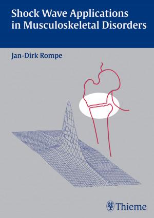 Cover of the book Shock Wave Applications in Musculoskeletal Disorders by Ian Jackson