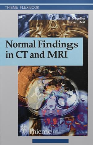 Book cover of Normal Findings in CT and MRI