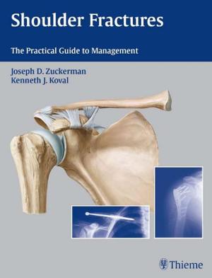 Cover of the book Shoulder Fractures by David Goldenberg, Bradley J. Goldstein