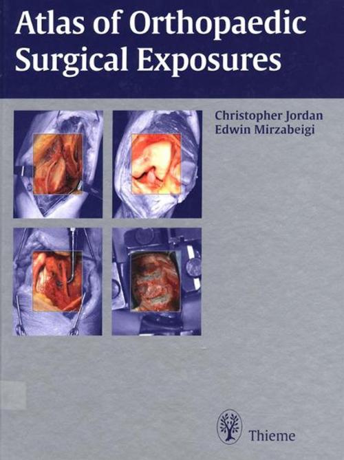 Cover of the book Atlas of Orthopaedic Surgical Exposures by Christopher Jordan, Edwin Mirzabeigi, Thieme