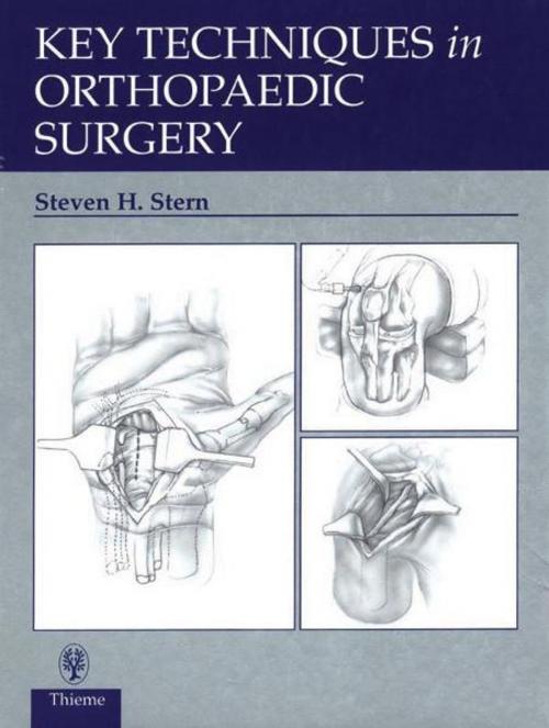 Cover of the book Key Techniques in Orthopaedic Surgery by Steven H. Stern, Thieme