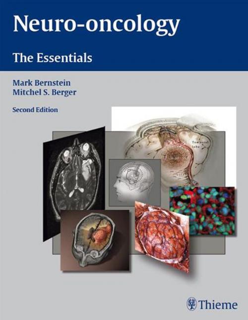 Cover of the book Neuro-Oncology: The Essentials by , Thieme