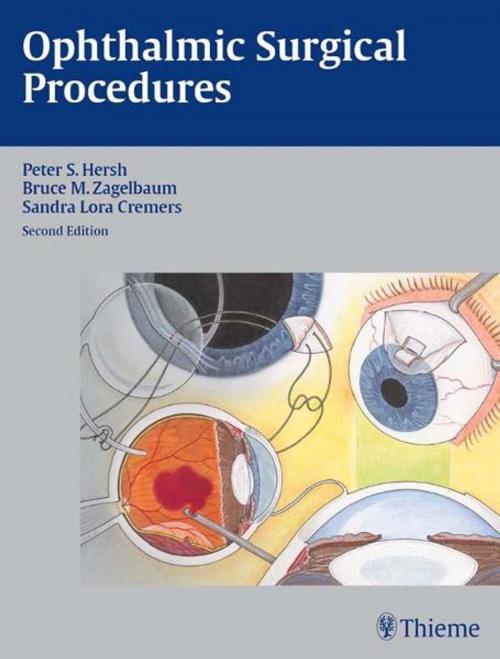 Cover of the book Ophthalmic Surgical Procedures by Peter S. Hersh, Bruce Mitchel Zagelbaum, Sandra Lora Cremers, Thieme