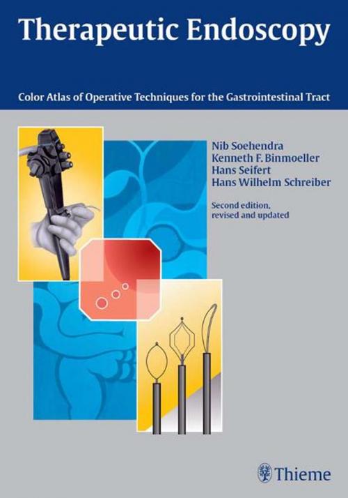 Cover of the book Therapeutic Endoscopy by N. Soehendra, Kenneth F. Binmoeller, Thieme