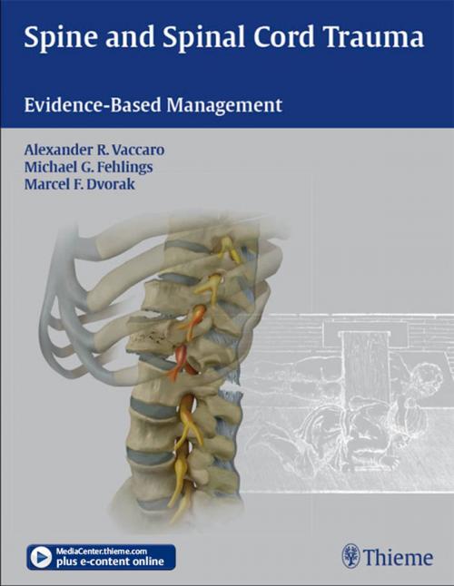 Cover of the book Spine and Spinal Cord Trauma by Alexander R. Vaccaro, Michael G. Fehlings, Thieme
