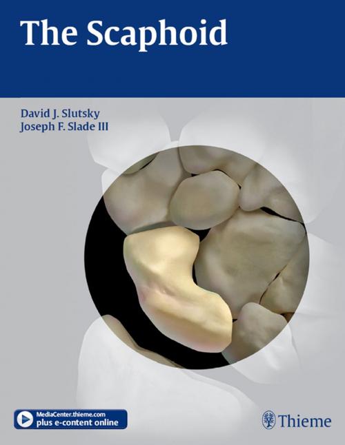 Cover of the book Scaphoid by , Thieme