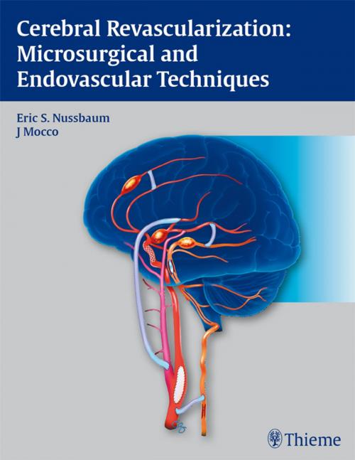 Cover of the book Cerebral Revascularization: Microsurgical and Endovascular Techniques by , Thieme