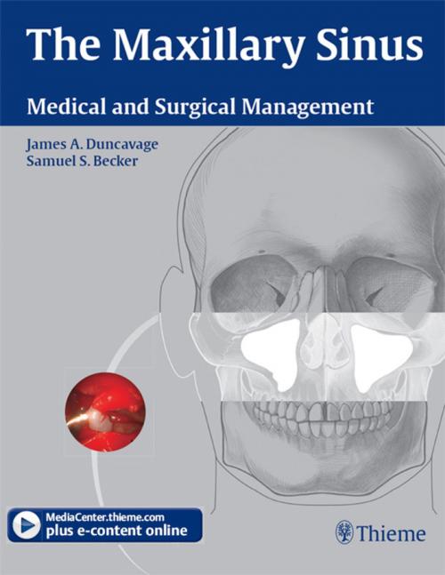 Cover of the book Maxillary Sinus by , Thieme