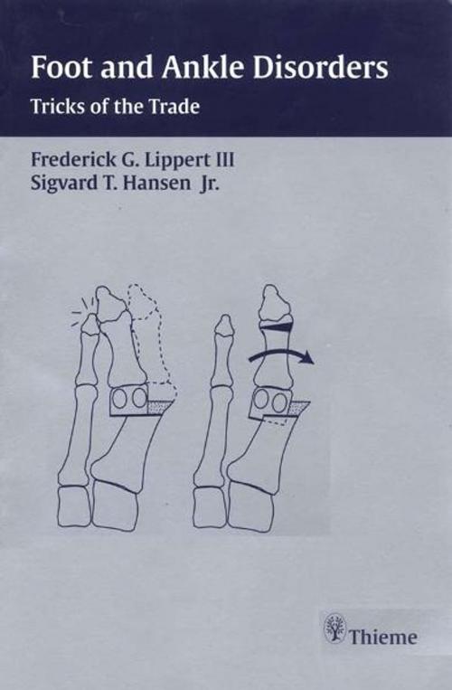 Cover of the book Foot and Ankle Disorders by Frederick G. Lippert, Sigvard T. Hansen, Thieme