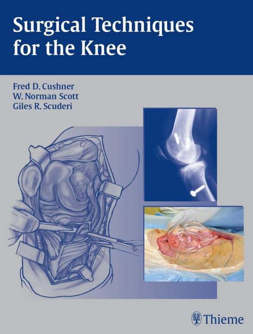 Cover of the book Surgical Techniques for the Knee by , Thieme