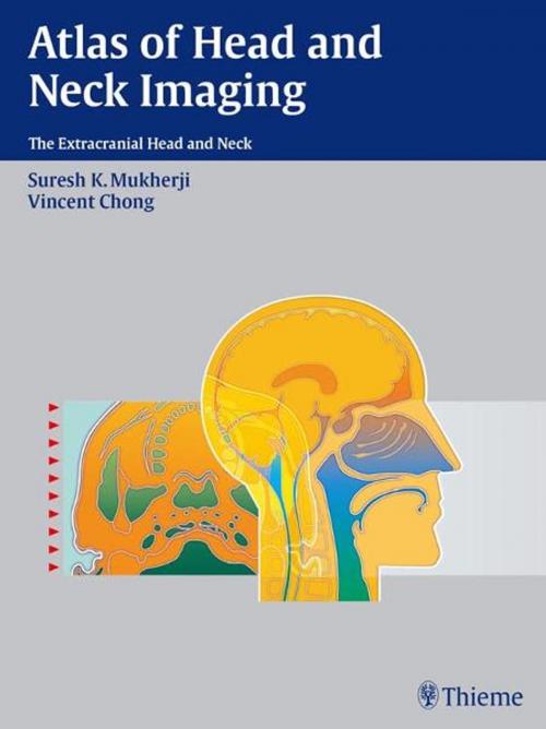 Cover of the book Atlas of Head and Neck Imaging by Vincent Chong, Suresh Kumar Mukherji, Thieme