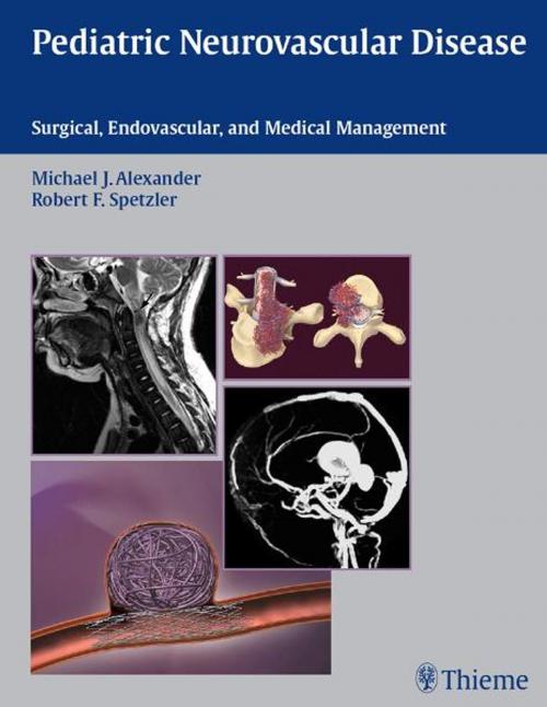 Cover of the book Pediatric Neurovascular Disease by , Thieme