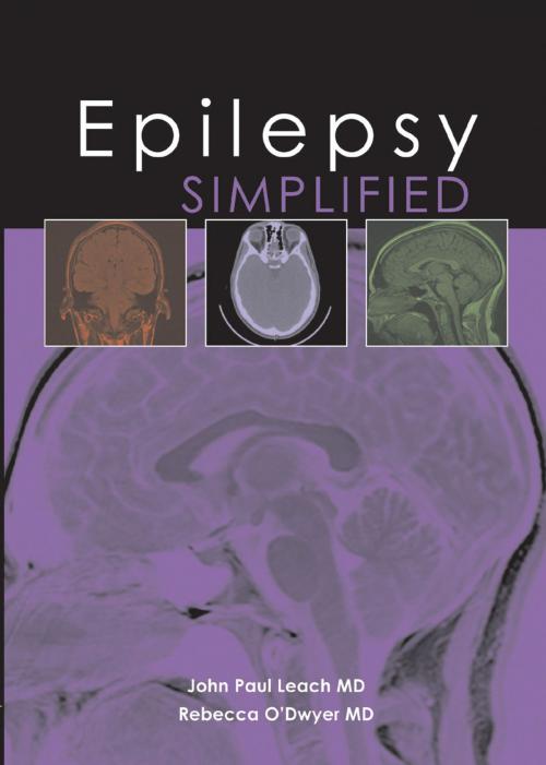 Cover of the book Epilepsy Simplified by John P Leach, Rebecca O'Dwyer, tfm Publishing Ltd