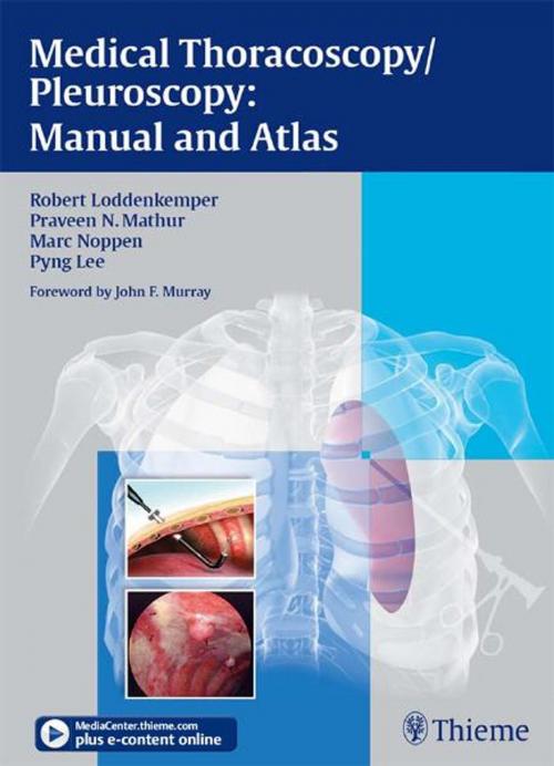 Cover of the book Medical Thoracoscopy/Pleuroscopy: Manual and Atlas by Robert Loddenkemper, Praveen N. Mathur, Thieme