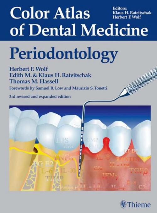 Cover of the book Color Atlas of Dental Medicine: Periodontology by Herbert F. Wolf, Edith M. Rateitschak-Pluss, Thieme