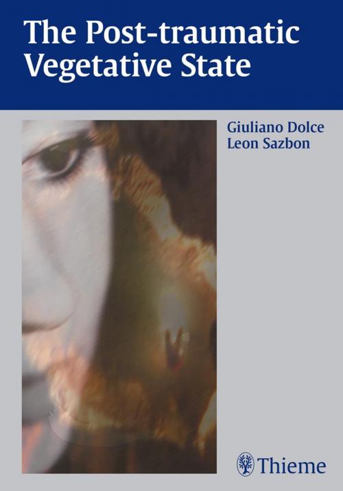 Cover of the book Post-Traumatic Vegetative State by Giuliano Dolce, Leon Sazbon, Thieme