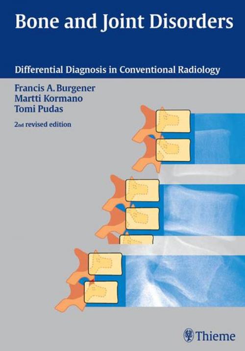 Cover of the book Bone and Joint Disorders by Martti Kormano, Francis A. Burgener, Thieme