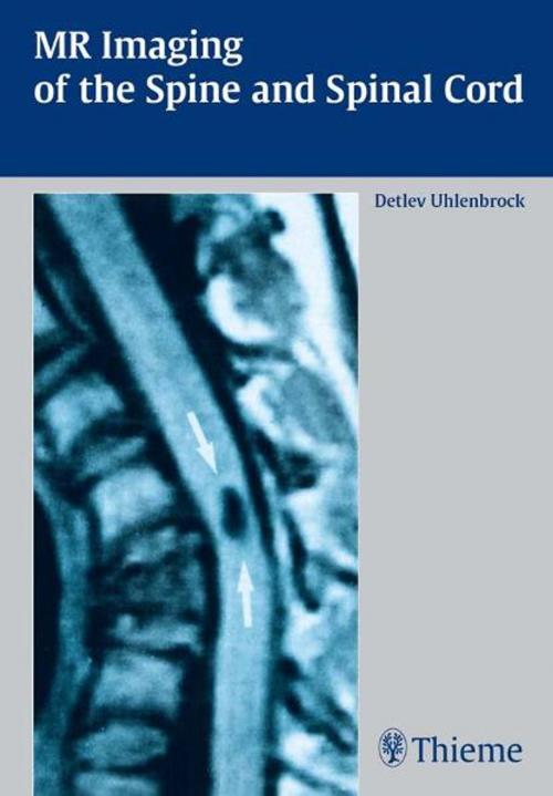 Cover of the book MR Imaging of the Spine and Spinal Cord by Detlev Uhlenbrock, Thieme