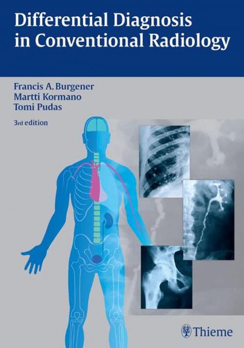 Cover of the book Differential Diagnosis in Conventional Radiology by Martti Kormano, Francis A. Burgener, Tomi Pudas, Thieme