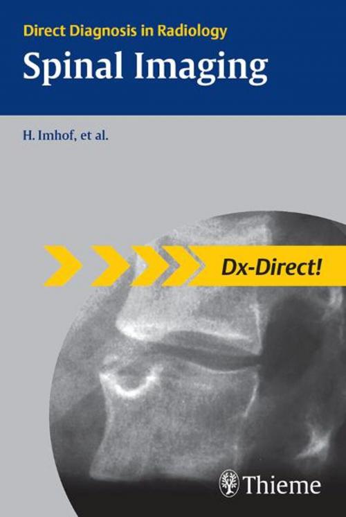 Cover of the book Spinal Imaging by Herwig Imhof, Benjamin Halpern, Thieme