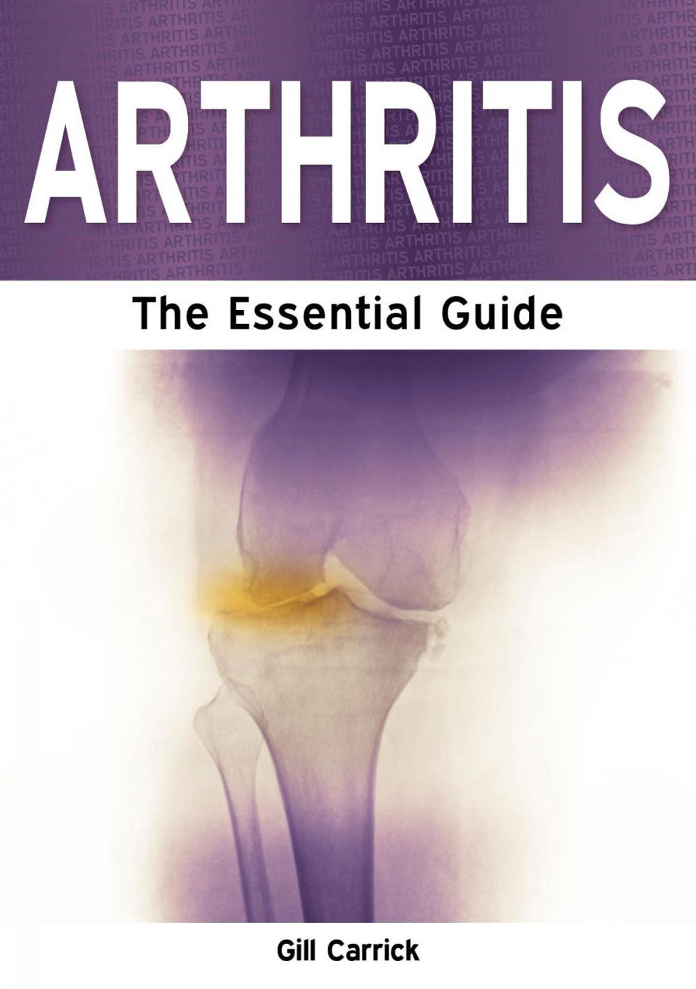 Big bigCover of Arthritis: The Essential Guide