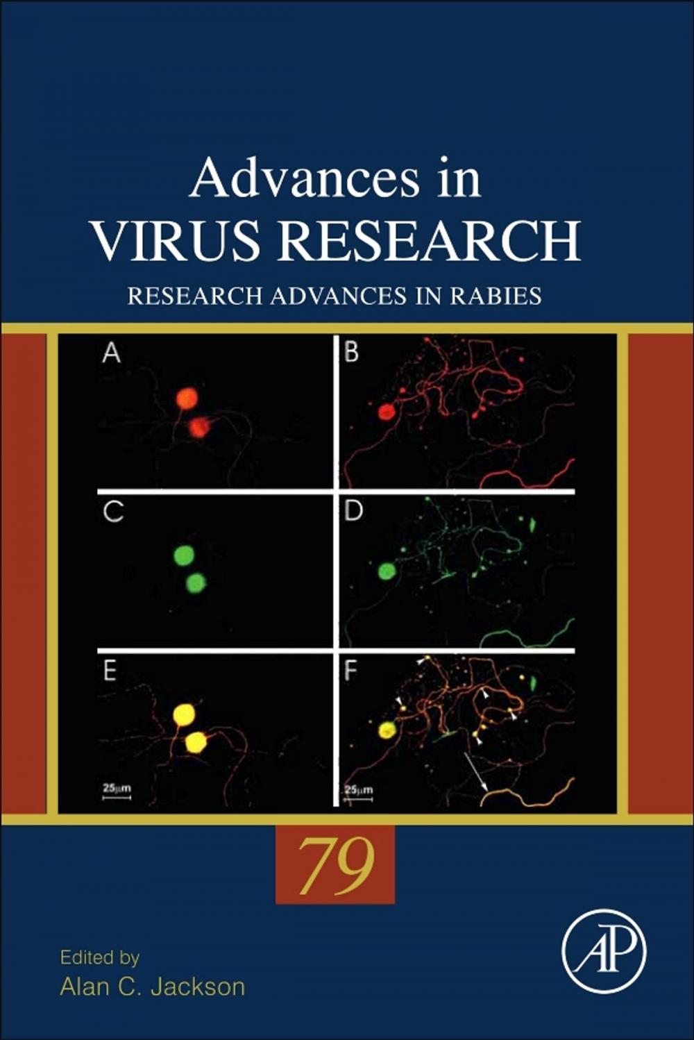 Big bigCover of Research Advances in Rabies