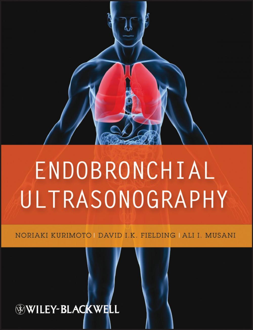 Big bigCover of Endobronchial Ultrasonography