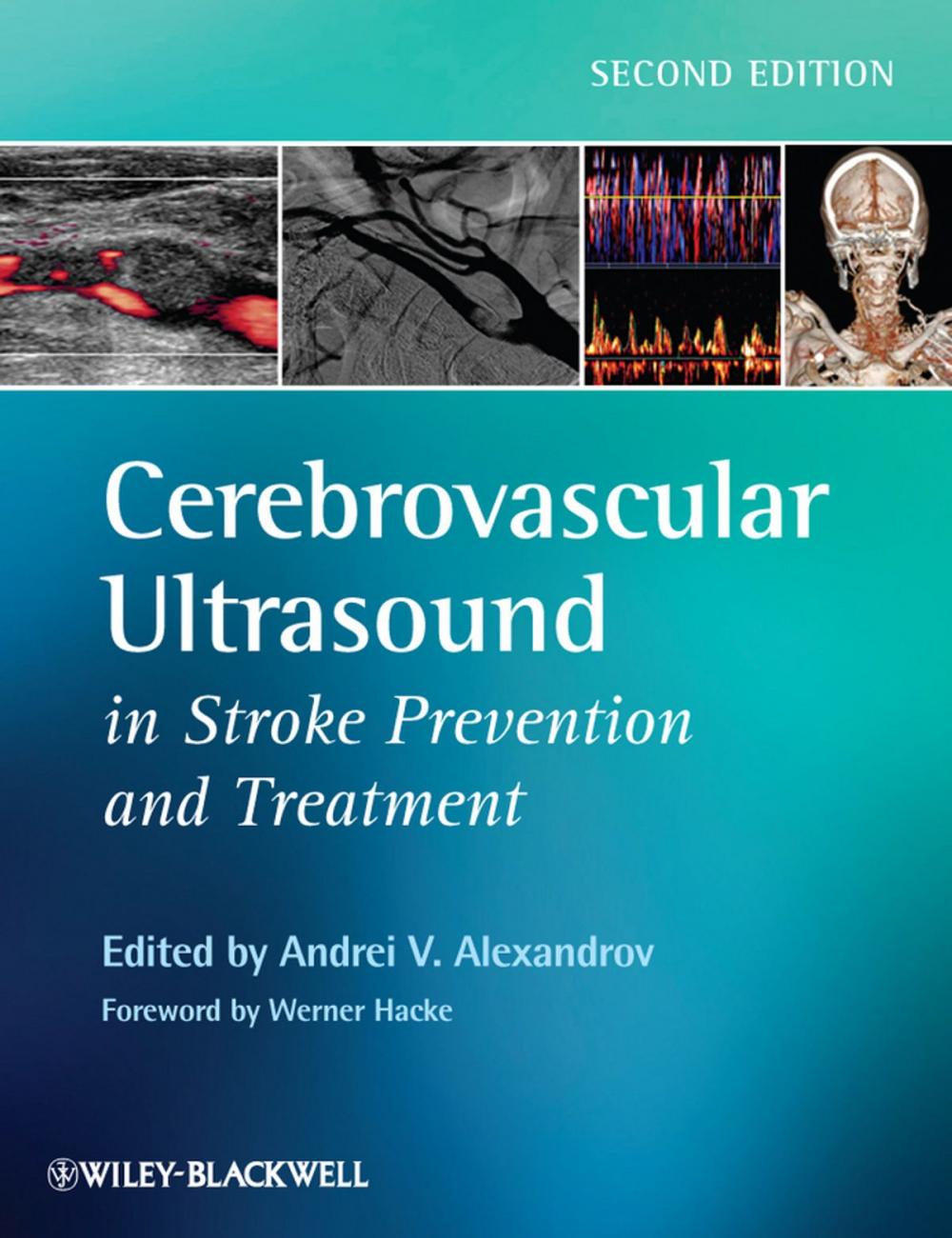 Big bigCover of Cerebrovascular Ultrasound in Stroke Prevention and Treatment