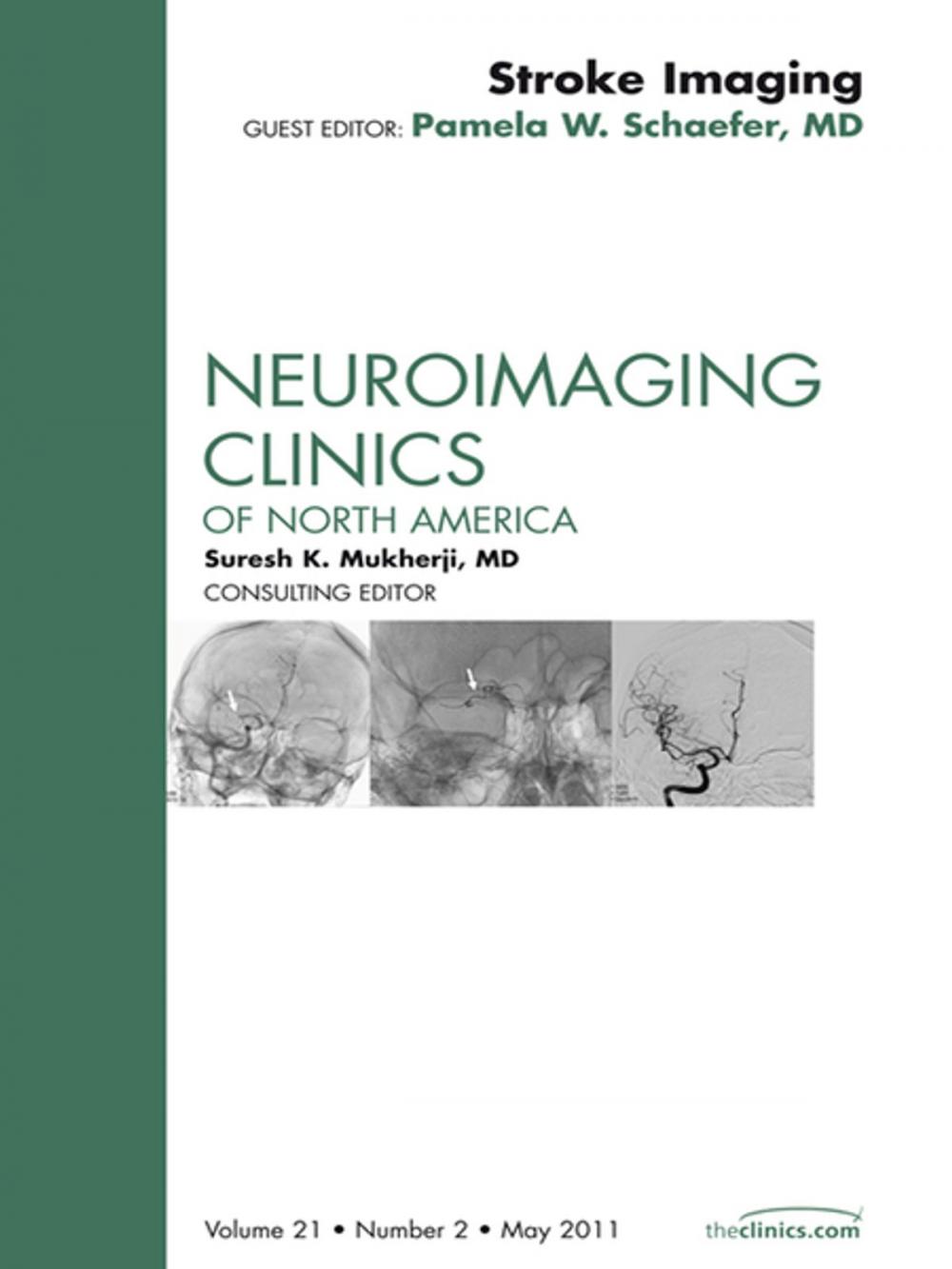 Big bigCover of Imaging of Ischemic Stroke, An Issue of Neuroimaging Clinics - E-Book